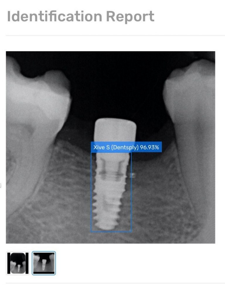 A.I. IN THE DENTAL WORLD