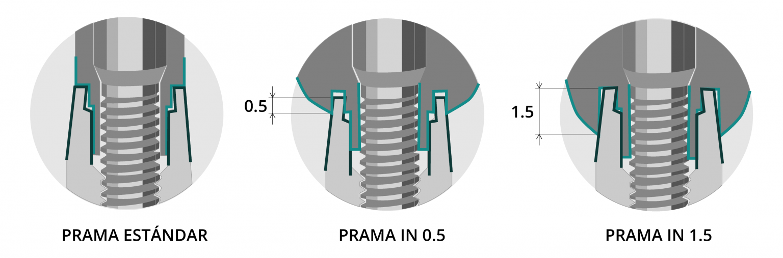 SWEDEN & MARTINA PRAMA IMPLANTS GTMedical Blog